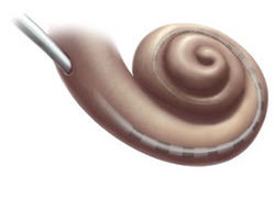Cochlear with Implant